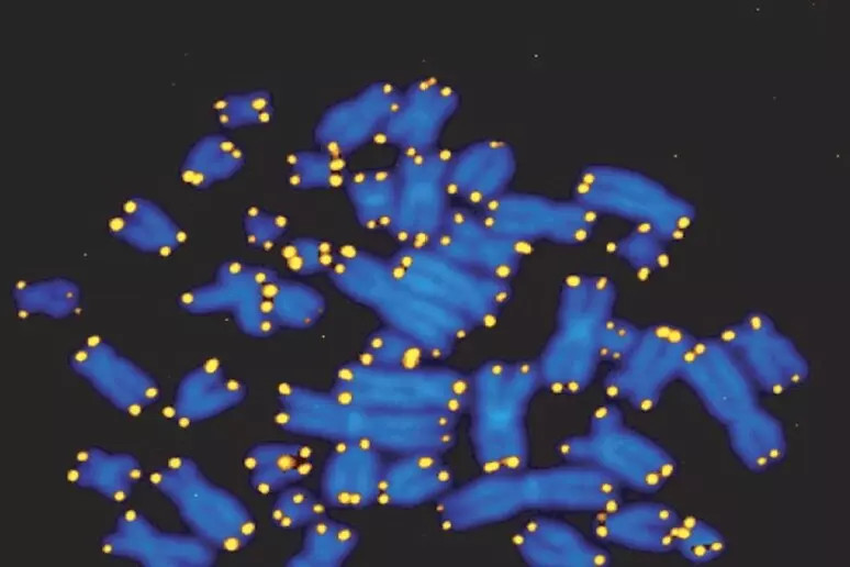 L'invecchiamento del Dna alla base dell'Alzheimer, lo studio italiano