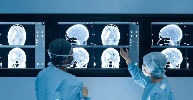 Ictus, scoperta la proteina “spia”: dirà quanto è grave e come evolverà, per cure e riabilitazione su misura