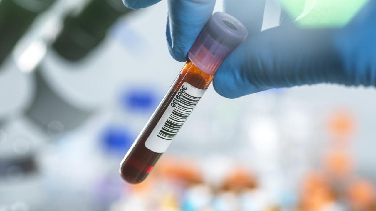 Uno studio rivela che esami del sangue per l'Alzheimer permettono di prevedere l'età in cui la malattia potrebbe causare sintomi