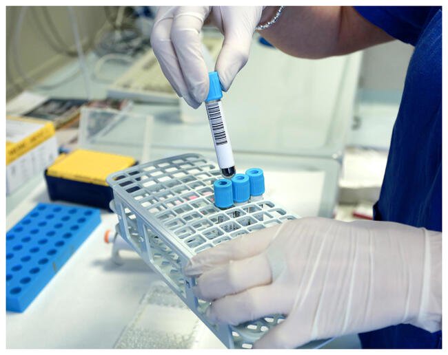 Nuove terapie contro il cancro, capire per chi funzionano davvero
